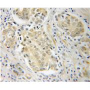 POT1 Rabbit Polyclonal Antibody (10581-1-AP)