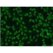 SUMO2 Rabbit Polyclonal Antibody (10947-1-AP)