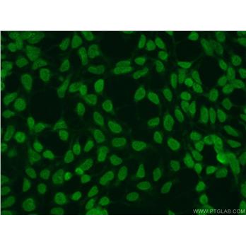 SUMO2 Rabbit Polyclonal Antibody (10947-1-AP)