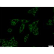 DBH Rabbit Polyclonal Antibody (10777-1-AP)
