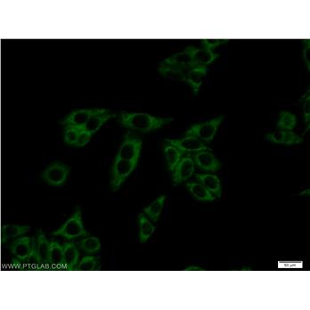 DBH Rabbit Polyclonal Antibody (10777-1-AP)