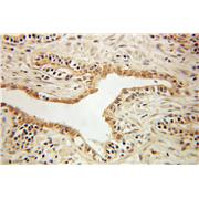BLVRA Rabbit Polyclonal Antibody (10775-1-AP)