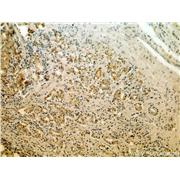KLK3 Rabbit Polyclonal Antibody (10679-1-AP)