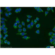 SHMT2 Rabbit Polyclonal Antibody (11099-1-AP)