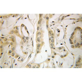 ETF1 Rabbit Polyclonal Antibody (10884-1-AP)