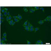 PANK2 Rabbit Polyclonal Antibody (11001-1-AP)