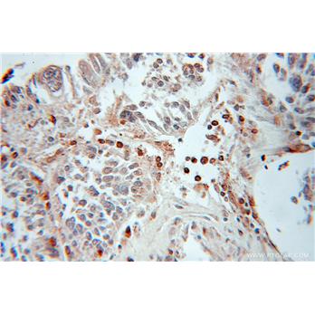 GABARAPL1 Rabbit Polyclonal Antibody (11010-1-AP)
