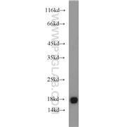 UBE2V2 Rabbit Polyclonal Antibody (10689-1-AP)
