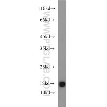 UBE2V2 Rabbit Polyclonal Antibody (10689-1-AP)