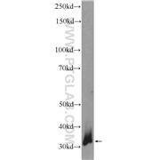 CTDSP1 Rabbit Polyclonal Antibody (10952-1-AP)