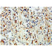 PHF11 Rabbit Polyclonal Antibody (10898-1-AP)