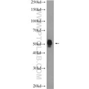 FBXW4 Rabbit Polyclonal Antibody (10657-1-AP)