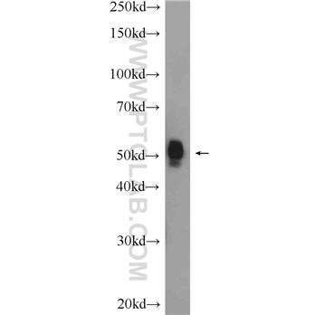 FBXW4 Rabbit Polyclonal Antibody (10657-1-AP)