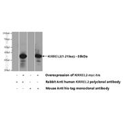 KIRREL2 Rabbit Polyclonal Antibody (10890-1-AP)