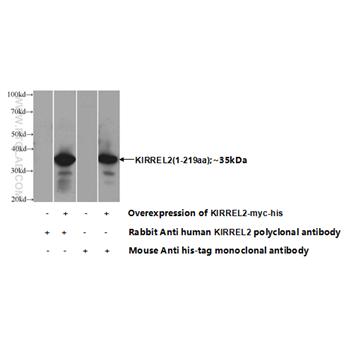 KIRREL2 Rabbit Polyclonal Antibody (10890-1-AP)