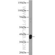 STRADB Rabbit Polyclonal Antibody (10688-1-AP)