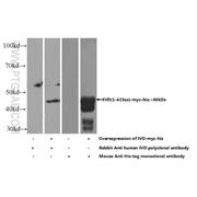 IVD Rabbit Polyclonal Antibody (10822-1-AP)