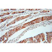 AK2 Rabbit Polyclonal Antibody (11014-1-AP)
