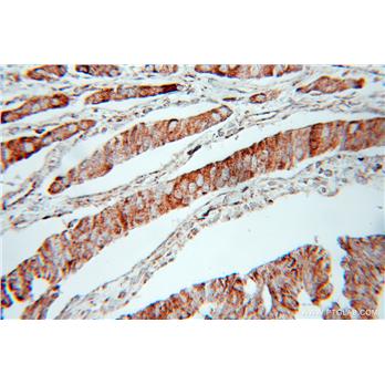 AK2 Rabbit Polyclonal Antibody (11014-1-AP)