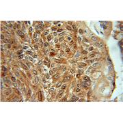 SGTA Rabbit Polyclonal Antibody (11019-2-AP)