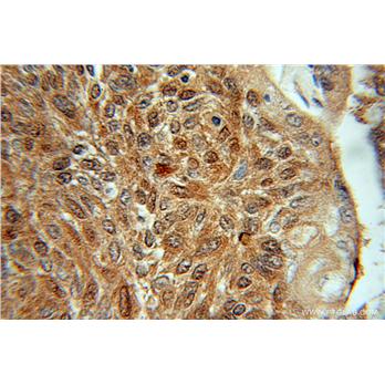 SGTA Rabbit Polyclonal Antibody (11019-2-AP)