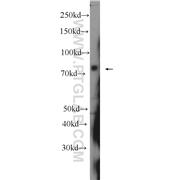 IGHM Rabbit Polyclonal Antibody (11016-1-AP)
