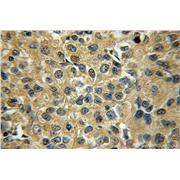 STXBP6 Rabbit Polyclonal Antibody (10976-4-AP)