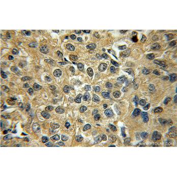 STXBP6 Rabbit Polyclonal Antibody (10976-4-AP)