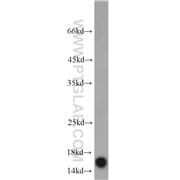 COTL1 Rabbit Polyclonal Antibody (10781-1-AP)