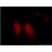 XRCC6 Rabbit Polyclonal Antibody (10723-1-AP)
