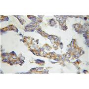 MMAB Rabbit Polyclonal Antibody (11137-1-AP)