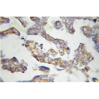 MMAB Rabbit Polyclonal Antibody (11137-1-AP)