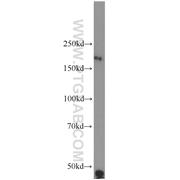 RTN4 Rabbit Polyclonal Antibody (10740-1-AP)