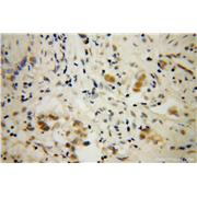 DAZAP1 Rabbit Polyclonal Antibody (11120-1-AP)