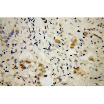 DAZAP1 Rabbit Polyclonal Antibody (11120-1-AP)