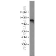 OPHN1 Rabbit Polyclonal Antibody (11076-1-AP)