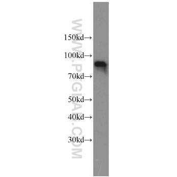 OPHN1 Rabbit Polyclonal Antibody (11076-1-AP)