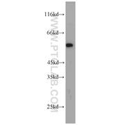 MYOT Rabbit Polyclonal Antibody (10731-1-AP)