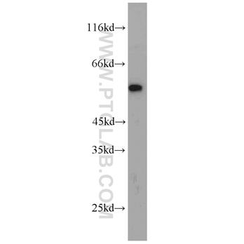 MYOT Rabbit Polyclonal Antibody (10731-1-AP)