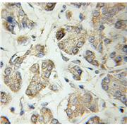 SCG3 Rabbit Polyclonal Antibody (10954-1-AP)
