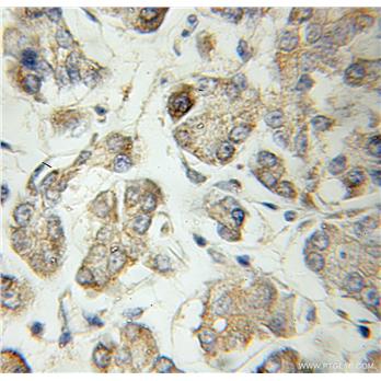 SCG3 Rabbit Polyclonal Antibody (10954-1-AP)