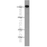 ADD1 Rabbit Polyclonal Antibody (10791-1-AP)