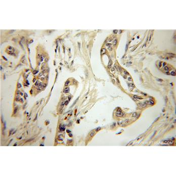 JSRP1 Rabbit Polyclonal Antibody (10854-1-AP)