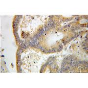 EPHX2 Rabbit Polyclonal Antibody (10833-1-AP)