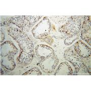 IFT81 Rabbit Polyclonal Antibody (10604-2-AP)