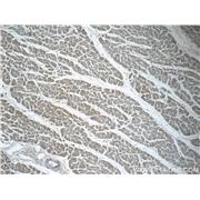 SDHB Rabbit Polyclonal Antibody (10620-1-AP)