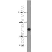 ETV4 Rabbit Polyclonal Antibody (10684-1-AP)