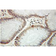 SPHK1 Rabbit Polyclonal Antibody (10670-1-AP)