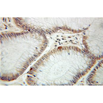 SPHK1 Rabbit Polyclonal Antibody (10670-1-AP)