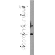 DTNBP1 Rabbit Polyclonal Antibody (11132-1-AP)